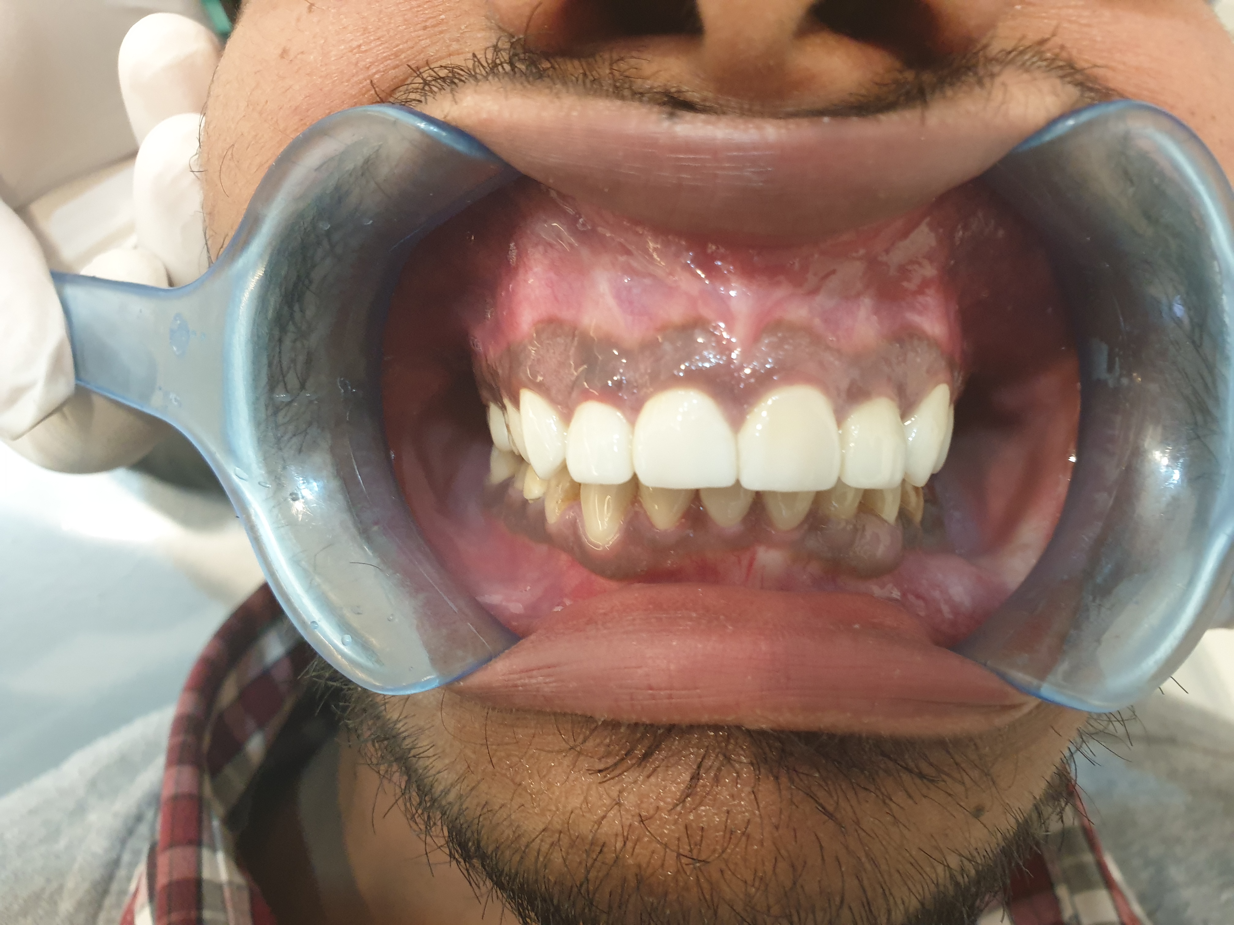 Stunning Dentistry Reviews 19 Reviews of